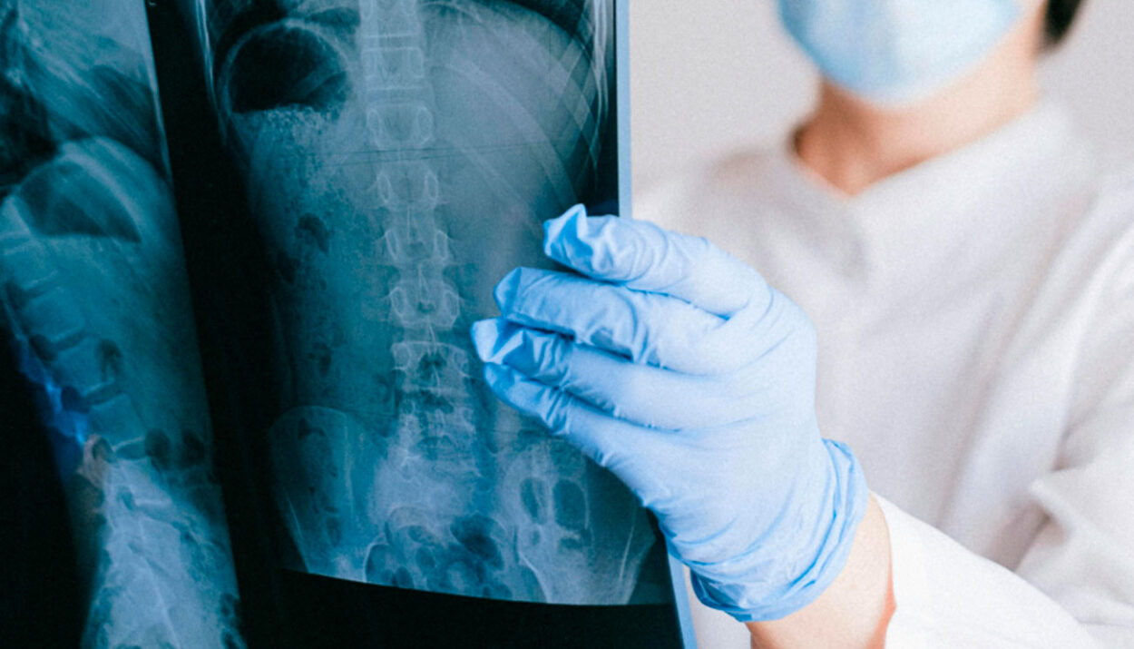 Imagen ilustrativa. (Pexels.com/Anna Shvets)