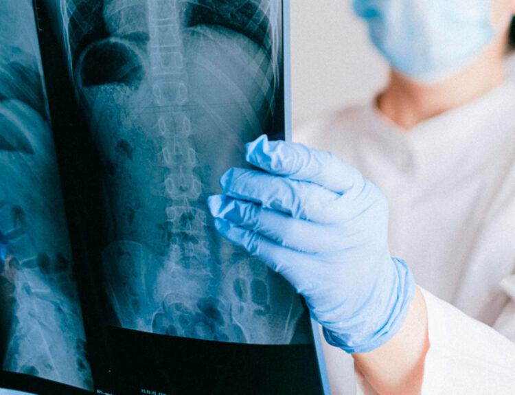 Imagen ilustrativa. (Pexels.com/Anna Shvets)